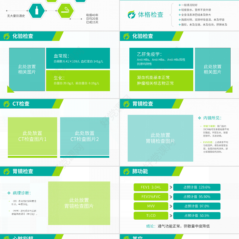 原创病例报告ppt模板医院病例分析讨论汇报