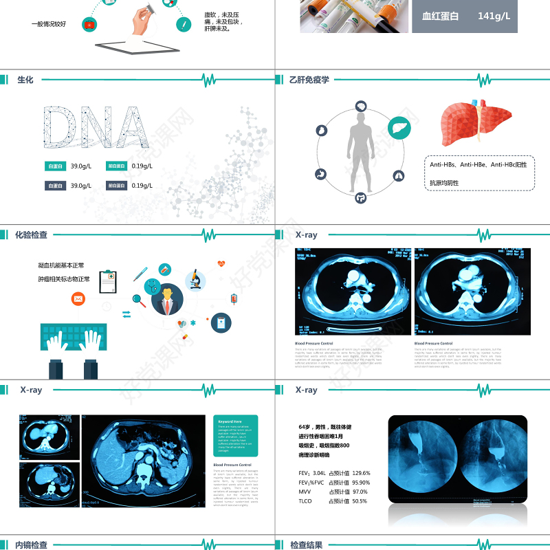 简约医院病历报告汇报小清新医疗事业案例分享PPT模板