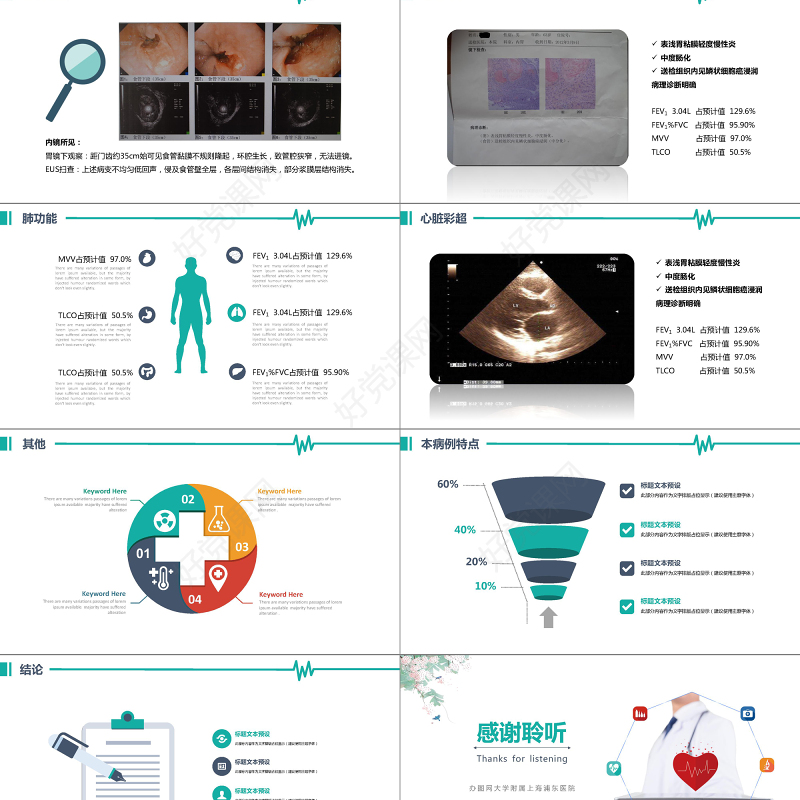 简约医院病历报告汇报小清新医疗事业案例分享PPT模板