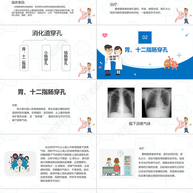 2022消化道穿孔医疗课件知识PPT医疗教学各种疾病医理PPT模板