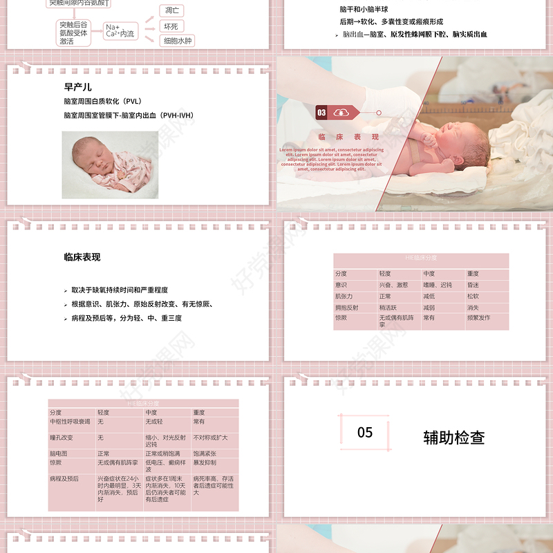 2022新生儿缺氧缺血性脑病PPT创意清新医疗教学各种疾病医理PPT模板