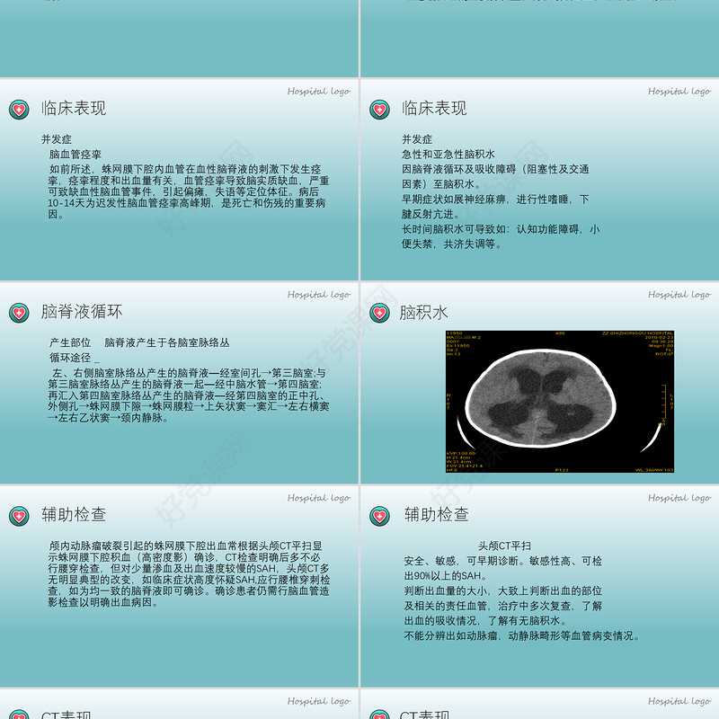 2022蛛网膜下腔出血PPT创意简约医疗教学各种疾病医理PPT模板