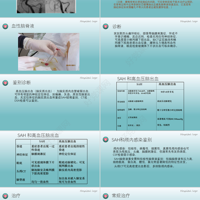 2022蛛网膜下腔出血PPT创意简约医疗教学各种疾病医理PPT模板