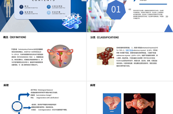 2022子宫肌瘤PPT医疗教学疾病医理类通用PPT模板